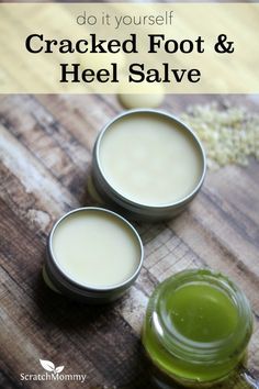 DIY Cracked Foot Salve Recipe (get your feet ready for spring and summer