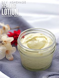 DIY Homemade Healing Lotion